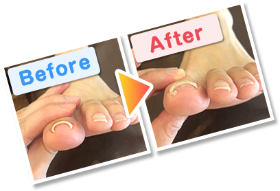 ビフォーアフター