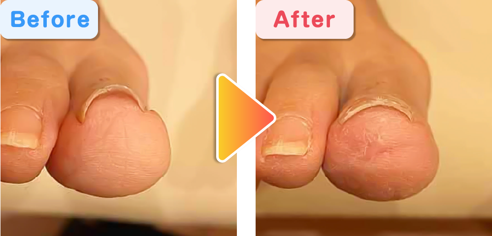 ビフォーアフター01