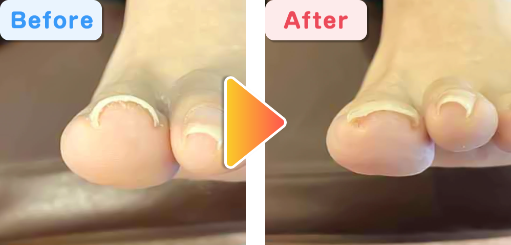 ビフォーアフター03