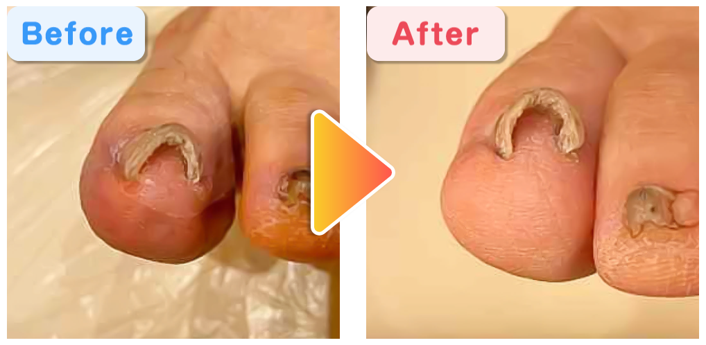 ビフォーアフター04