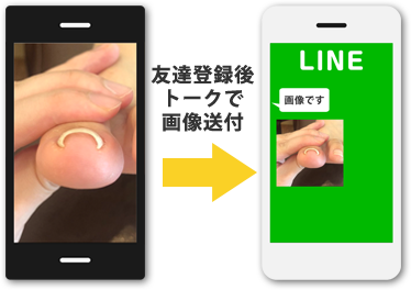 LINEで画像を送付画像